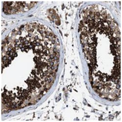 TBC1D15 Rabbit anti-Human, Mouse, Rat, Polyclonal Antibody, Abnova 100&mu;L;