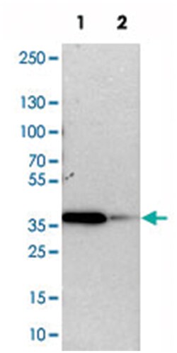 TOR1B Rabbit anti-Human, Mouse, Rat, Polyclonal Antibody, Abnova 100 &mu;L | Buy Online | Abnova Corporation | Fisher Scientific