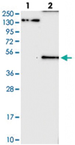 KCNJ5 Rabbit anti-Human, Polyclonal Antibody, Abnova 100&mu;L; Unlabeled:Antibodies,