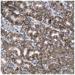 GHITM Rabbit anti-Human, Polyclonal Antibody, Abnova 100 &mu;L | Buy Online | Abnova Corporation | Fisher Scientific