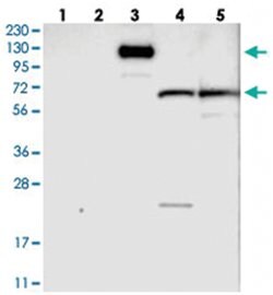 ITIH3, Rabbit, Polyclonal Antibody, Abnova 100&mu;L; Unlabeled:Antibodies,