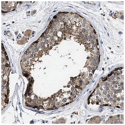 TMEM131 Rabbit anti-Human, Polyclonal Antibody, Abnova 100 &mu;L | Buy Online | Abnova Corporation | Fisher Scientific