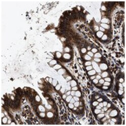 KTN1 Rabbit anti-Human, Polyclonal Antibody, Abnova 100&mu;L; Unlabeled:Antibodies,