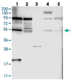 TOX4 Rabbit anti-Human, Mouse, Rat, Polyclonal Antibody, Abnova 100 &mu;L | Buy Online | Abnova Corporation | Fisher Scientific