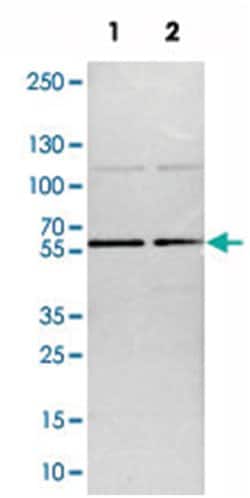 TOX4 Rabbit anti-Human, Mouse, Rat, Polyclonal Antibody, Abnova 100 &mu;L | Buy Online | Abnova Corporation | Fisher Scientific