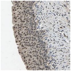 TOX4 Rabbit anti-Human, Mouse, Rat, Polyclonal Antibody, Abnova 100 &mu;L | Buy Online | Abnova Corporation | Fisher Scientific