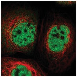 TOX4 Rabbit anti-Human, Mouse, Rat, Polyclonal Antibody, Abnova 100 &mu;L | Buy Online | Abnova Corporation | Fisher Scientific