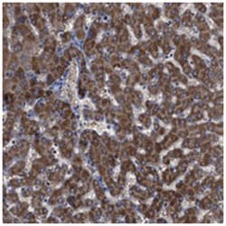 GPR179, Rabbit, Polyclonal Antibody, Abnova 100 &mu;L | Buy Online | Abnova Corporation | Fisher Scientific