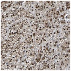 RRP1B Rabbit anti-Human, Polyclonal Antibody, Abnova 100&mu;L; Unlabeled:Antibodies,