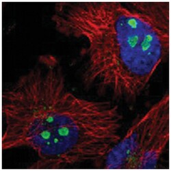 RRP1B Rabbit anti-Human, Polyclonal Antibody, Abnova 100&mu;L; Unlabeled:Antibodies,