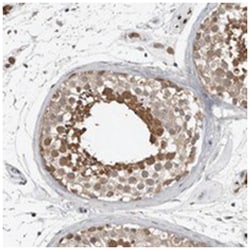 MFAP3L, Rabbit, Polyclonal Antibody, Abnova 100 &mu;L | Buy Online | Abnova Corporation | Fisher Scientific