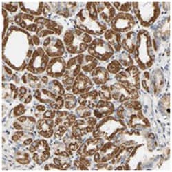 BMPER, Rabbit, Polyclonal Antibody, Abnova 100 &mu;L | Buy Online | Abnova Corporation | Fisher Scientific