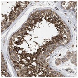 NAV1 Rabbit anti-Human, Polyclonal Antibody, Abnova 100&mu;L; Unlabeled:Antibodies,