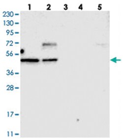 TOX Rabbit anti-Human, Mouse, Rat, Polyclonal Antibody, Abnova 100&mu;L;