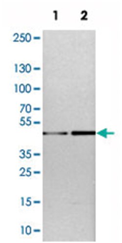 TOX Rabbit anti-Human, Mouse, Rat, Polyclonal Antibody, Abnova 100&mu;L;