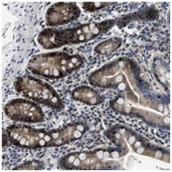 TOX Rabbit anti-Human, Mouse, Rat, Polyclonal Antibody, Abnova 100&mu;L;