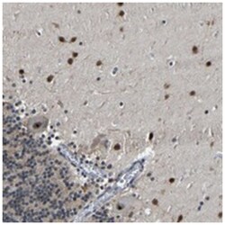 PPM1E Rabbit anti-Human, Polyclonal Antibody, Abnova 100&mu;L; Unlabeled:Antibodies,