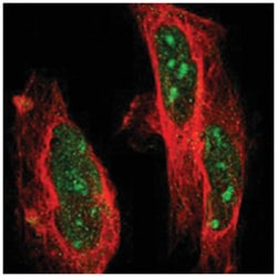 PPM1E Rabbit anti-Human, Polyclonal Antibody, Abnova 100&mu;L; Unlabeled:Antibodies,