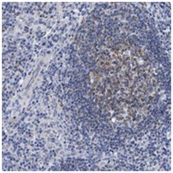 LRMP Rabbit anti-Human, Polyclonal Antibody, Abnova 100 &mu;L | Buy Online | Abnova Corporation | Fisher Scientific