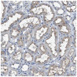 SLC38A6, Rabbit, Polyclonal Antibody, Abnova 100 &mu;L | Buy Online | Abnova Corporation | Fisher Scientific