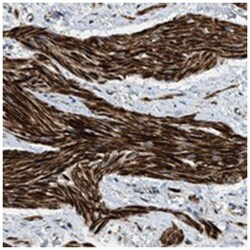 ERGIC1 Rabbit anti-Human, Polyclonal Antibody, Abnova 100&mu;L; Unlabeled:Antibodies,