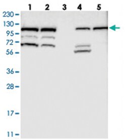 RASGRF2, Rabbit, Polyclonal Antibody, Abnova 100 &mu;L | Buy Online | Abnova Corporation | Fisher Scientific