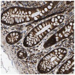 RASGRF2, Rabbit, Polyclonal Antibody, Abnova 100 &mu;L | Buy Online | Abnova Corporation | Fisher Scientific