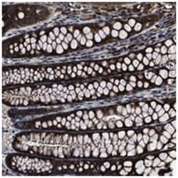 ANGPT1 Rabbit anti-Human, Polyclonal Antibody, Abnova 100 &mu;L | Buy Online | Abnova Corporation | Fisher Scientific