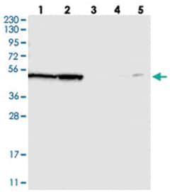 NLE1, Rabbit, Polyclonal Antibody, Abnova 100&mu;L; Unlabeled:Antibodies,