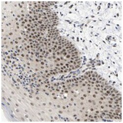 NLE1, Rabbit, Polyclonal Antibody, Abnova 100&mu;L; Unlabeled:Antibodies,