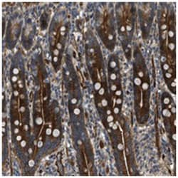 KIAA1305, Rabbit, Polyclonal Antibody, Abnova 100&mu;L; Unlabeled:Antibodies,