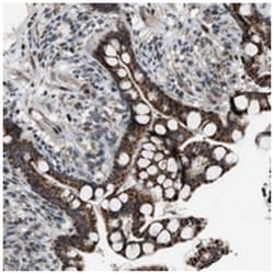 CHN2, Rabbit, Polyclonal Antibody, Abnova 100&mu;L; Unlabeled:Antibodies,