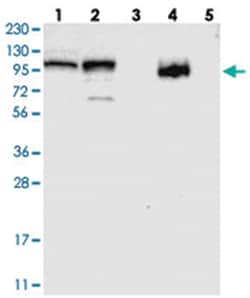 RBM28 Rabbit anti-Human, Polyclonal Antibody, Abnova 100 &mu;L | Buy Online | Abnova Corporation | Fisher Scientific
