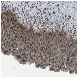 RBM28 Rabbit anti-Human, Polyclonal Antibody, Abnova 100 &mu;L | Buy Online | Abnova Corporation | Fisher Scientific