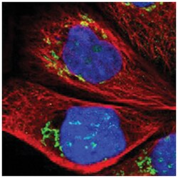 RBM28 Rabbit anti-Human, Polyclonal Antibody, Abnova 100 &mu;L | Buy Online | Abnova Corporation | Fisher Scientific