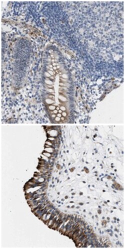 TWISTNB Rabbit anti-Human, Polyclonal Antibody, Abnova 100 &mu;L | Buy Online | Abnova Corporation | Fisher Scientific