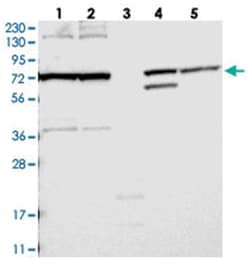FAM161B, Rabbit, Polyclonal Antibody, Abnova 100 &mu;L | Buy Online | Abnova Corporation | Fisher Scientific