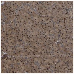 FAM161B, Rabbit, Polyclonal Antibody, Abnova 100 &mu;L | Buy Online | Abnova Corporation | Fisher Scientific
