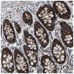 PPM1E Rabbit anti-Human, Polyclonal Antibody, Abnova 100&mu;L; Unlabeled:Antibodies,