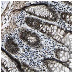 PRCC Rabbit anti-Human, Polyclonal Antibody, Abnova 100&mu;L; Unlabeled:Antibodies,