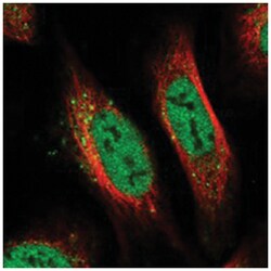 PRCC Rabbit anti-Human, Polyclonal Antibody, Abnova 100&mu;L; Unlabeled:Antibodies,