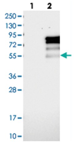 PRCC Rabbit anti-Human, Polyclonal Antibody, Abnova 100&mu;L; Unlabeled:Antibodies,