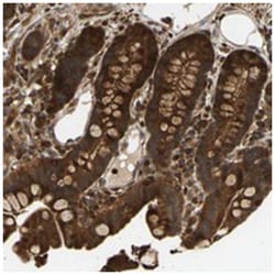 GOPC Rabbit anti-Human, Polyclonal Antibody, Abnova 100 &mu;L | Buy Online | Abnova Corporation | Fisher Scientific