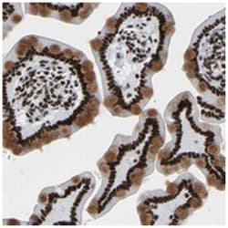PRCC Rabbit anti-Human, Polyclonal Antibody, Abnova 100&mu;L; Unlabeled:Antibodies,