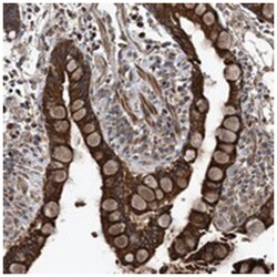 C22orf15 Rabbit anti-Human, Polyclonal Antibody, Abnova 100 &mu;L | Buy Online | Abnova Corporation | Fisher Scientific