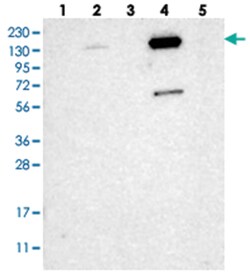 ZNF629, Rabbit, Polyclonal Antibody, Abnova 100 &mu;L | Buy Online | Abnova Corporation | Fisher Scientific