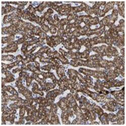 ZNF629, Rabbit, Polyclonal Antibody, Abnova 100 &mu;L | Buy Online | Abnova Corporation | Fisher Scientific