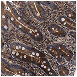 ABCG8 Rabbit anti-Human, Polyclonal Antibody, Abnova 100&mu;L; Unlabeled:Antibodies,