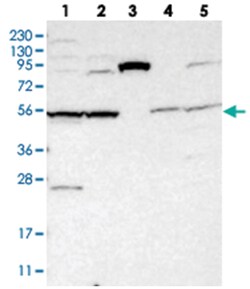 SLC35F1, Rabbit, Polyclonal Antibody, Abnova 100&mu;L; Unlabeled:Antibodies,