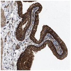 MYO18A Rabbit anti-Human, Polyclonal Antibody, Abnova 100 &mu;L | Buy Online | Abnova Corporation | Fisher Scientific